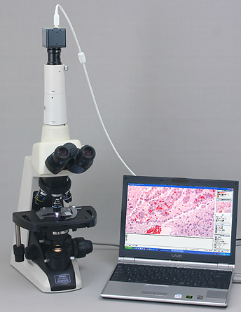 顕微鏡用CマウントCCDカメラ　接続アダプターセット