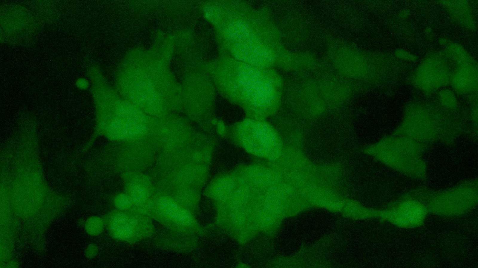 ニコン顕微鏡Eclipse Si HeLa細胞、透過蛍光観察　GFP染色