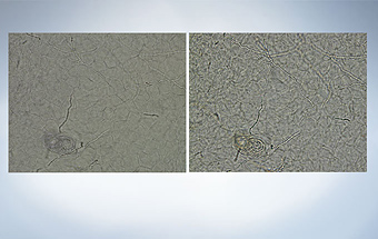 CX33　コンデンサーコントラスト　白癬菌