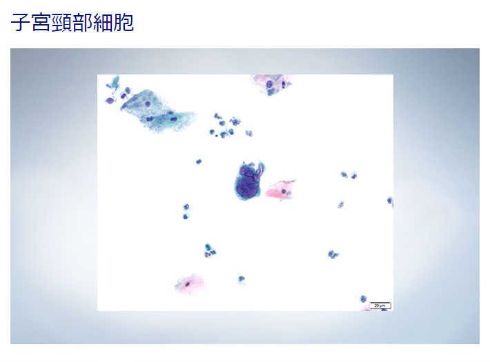 CX43観察　子宮頸部細胞